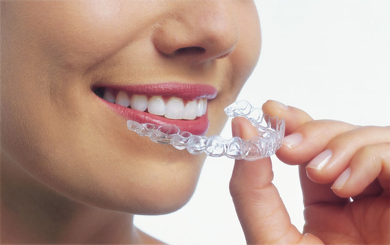 A woman placing her invisalign braces