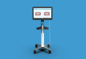 Itero 5D scanner on the blue background