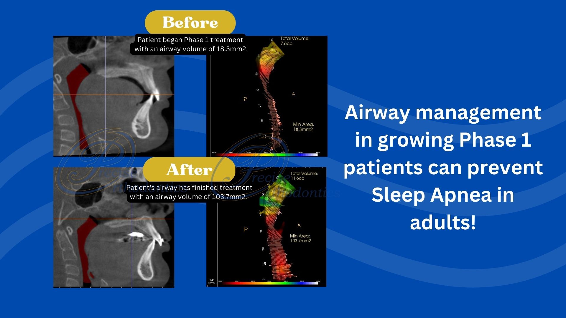 Airway management flyer on the display